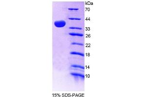 SDS-PAGE analysis of Mouse GBP4 Protein. (GBP4 Protein)