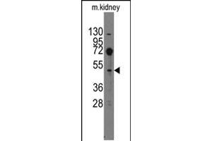 Western blot analysis of anti-Evx2 Pab in mouse kidney tissue lysates (35ug/lane)