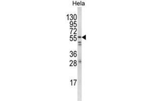 Western blot analysis of FYN Antibody (N-term) in Hela cell line lysates (35ug/lane). (FYN Antikörper  (N-Term))