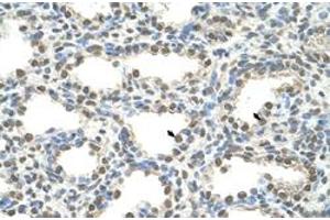 Immunohistochemical staining (Formalin-fixed paraffin-embedded sections) of human lung with FOXQ1 polyclonal antibody  at 4-8 ug/mL working concentration. (FOXQ1 Antikörper  (N-Term))