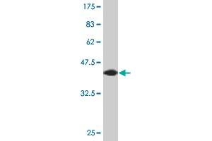 Western Blot detection against Immunogen (44. (AGR2 Antikörper  (AA 1-175))