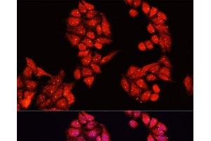 Immunofluorescence analysis of HeLa cells using ALDH9A1 Polyclonal Antibody at dilution of 1:100. (ALDH9A1 Antikörper)