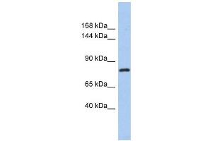 KLHL32 antibody used at 1 ug/ml to detect target protein. (KLHL32 Antikörper)