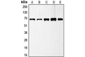 Western blot analysis of GAD1 expression in A549 (A), MCF7 (B), SP2/0 (C), PC12 (D), SKNSH (E) whole cell lysates. (GAD Antikörper  (C-Term))