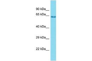 Western Blotting (WB) image for anti-Protease, Serine, 56 (PRSS56) (C-Term) antibody (ABIN2791462)