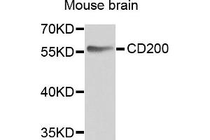 Western blot analysis of extracts of mouse brain, using CD200 antibody. (CD200 Antikörper)