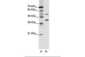 Image no. 1 for anti-REX4, RNA Exonuclease 4 Homolog (REXO4) (AA 270-319) antibody (ABIN6736107) (REXO4 Antikörper  (AA 270-319))