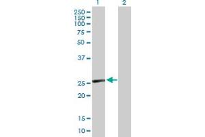 Western Blot analysis of CD8B expression in transfected 293T cell line by CD8B MaxPab polyclonal antibody. (CD8B Antikörper  (AA 1-243))