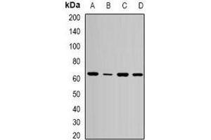 Western blot analysis of SPE39 expression in MCF7 (A), HepG2 (B), mouse liver (C), mouse kidney (D) whole cell lysates. (VIPAR Antikörper)