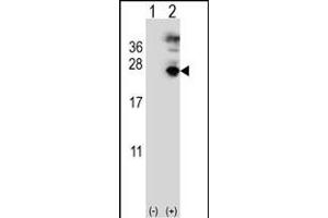 Western blot analysis of MF (arrow) using rabbit polyclonal MF Antibody (C-term) (ABIN391487 and ABIN2841455).