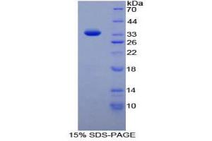 SDS-PAGE (SDS) image for Protein tyrosine Phosphatase, Receptor Type, J (PTPRJ) (AA 567-842) protein (His tag) (ABIN1980961)