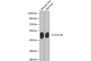 Western blot analysis of extracts of various cell lines using CYP2C18 Polyclonal Antibody at dilution of 1:1000. (CYP2C18 Antikörper)