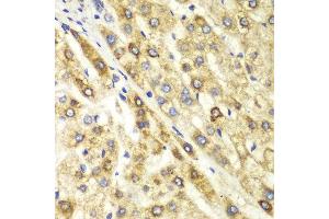 Immunohistochemistry (IHC) image for anti-C-terminal Binding Protein 1 (CTBP1) (AA 20-250) antibody (ABIN6218809) (CTBP1 Antikörper  (AA 20-250))