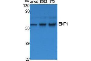 Western Blotting (WB) image for anti-Solute Carrier Family 29 (Nucleoside Transporters), Member 1 (SLC29A1) (N-Term) antibody (ABIN3187600)