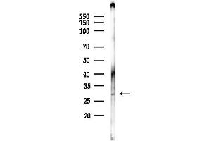 anti-Dolichyl Pyrophosphate Phosphatase 1 (DOLPP1) antibody