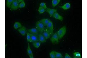Immunofluorescence staining of Hela cells with ABIN7139823 at 1:166, counter-stained with DAPI. (EIF4G3 Antikörper  (AA 158-176))
