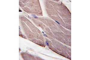 Formalin-fixed and paraffin-embedded human skeletal muscle tissue reacted with PDK4-E265, which was peroxidase-conjugated to the secondary antibody, followed by DAB staining. (PDK4 Antikörper  (AA 250-277))