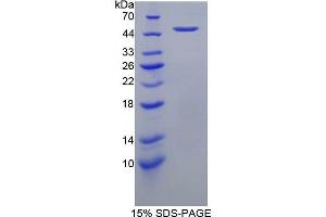 SDS-PAGE (SDS) image for Interleukin 31 (IL31) (AA 134-262) protein (His tag,GST tag) (ABIN2123084) (IL-31 Protein (AA 134-262) (His tag,GST tag))