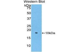 Western Blotting (WB) image for anti-Periostin (POSTN) (AA 24-173) antibody (ABIN1176623) (Periostin Antikörper  (AA 24-173))