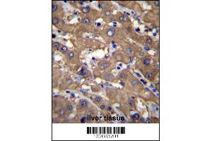 UGDH Antibody immunohistochemistry analysis in formalin fixed and paraffin embedded human liver tissue followed by peroxidase conjugation of the secondary antibody and DAB staining. (UGDH Antikörper  (C-Term))