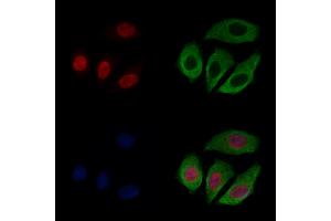 CASC5 Antibody staining Hela cells by IF/ICC. (CASC5 Antikörper  (Internal Region))