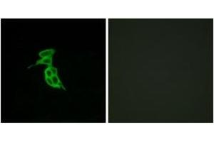 Immunofluorescence analysis of LOVO cells, using GPR143 Antibody. (GPR143 Antikörper  (AA 151-200))