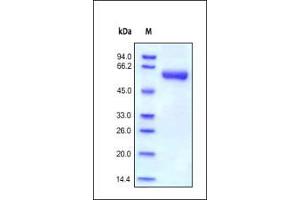Human MMP-9, His Tag on SDS-PAGE under reducing (R) condition. (MMP 9 Protein (AA 20-469) (His tag))