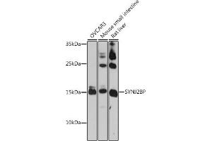 Western blot analysis of extracts of various cell lines, using SYNJ2BP antibody (ABIN7270667) at 1:1000 dilution. (SYNJ2BP Antikörper  (AA 1-145))