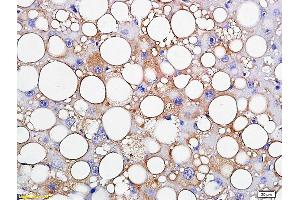 Formalin-fixed and paraffin embedded rat liver labeled with Anti-TIP47/M6PRBP1 Polyclonal Antibody, Unconjugated (ABIN681613) followed by conjugation to the secondary antibody and DAB staining (PLIN3 Antikörper  (AA 351-434))