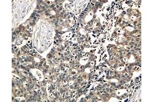 Immunohistochemistry (IHC) image for anti-DOK2 (DOK2) (pTyr299) antibody (ABIN3019935) (DOK2 Antikörper  (pTyr299))