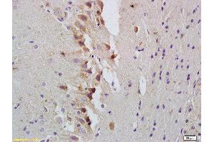 Formalin-fixed and paraffin embedded rat brain labeled with Rabbit Anti-STAT1 Polyclonal Antibody, Unconjugated  at 1:200 followed by conjugation to the secondary antibody and DAB staining (STAT1 Antikörper  (AA 251-380))