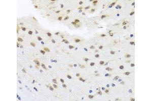 Immunohistochemistry of paraffin-embedded Mouse brain using HDAC4 Polyclonal Antibody at dilution of 1:100 (40x lens). (HDAC4 Antikörper)