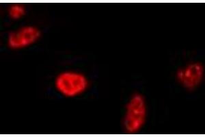 Immunofluorescent analysis of RAD17 staining in A549 cells.