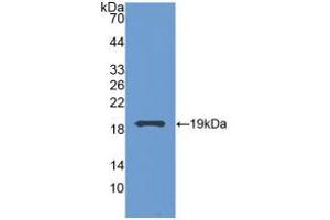 Western blot analysis of recombinant Human GCA. (Grancalcin Antikörper  (AA 1-139))
