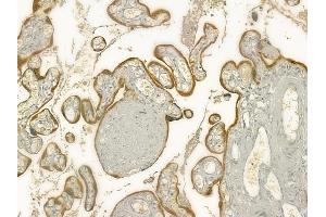 ABIN6260919 and ABIN6277317 at 1/100 staining human normal placenta tissue by IHC-P. (CNTF Receptor alpha Antikörper  (Internal Region))