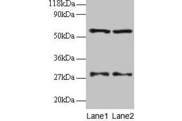 Seryl-tRNA Synthetase (SARS) (AA 2-233) Antikörper