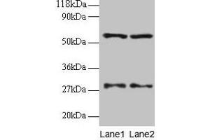 Western blot All lanes: SARS antibody at 2 μg/mL Lane 1: EC109 whole cell lysate Lane 2: 293T whole cell lysate Secondary Goat polyclonal to rabbit IgG at 1/15000 dilution Predicted band size: 59 kDa Observed band size: 59 kDa (Seryl-tRNA Synthetase (SARS) (AA 2-233) Antikörper)
