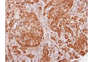 Immunohistochemistry (IHC) image for anti-SEC13 Homolog (SEC13) (Center) antibody (ABIN2854912)