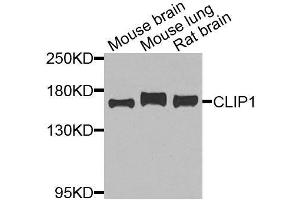 Western blot analysis of extracts of various cell lines, using CLIP1 antibody. (CLIP1 Antikörper  (AA 1228-1427))