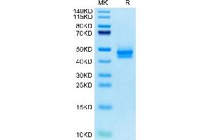 Cynomolgus IL-12B on Tris-Bis PAGE under reduced condition. (IL12B Protein (AA 23-328) (His tag))
