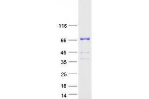 Validation with Western Blot (DLAT Protein (Myc-DYKDDDDK Tag))