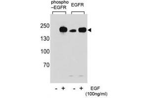 Western blot analysis of extracts from A431 cells,untreated or treated with EGF, using p-EGFR antibody (left) or nonphos Ab (right).