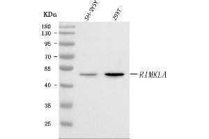 Western blot analysis of RIMKLA using anti-RIMKLA antibody (ABIN7600414).