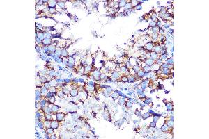 Immunohistochemistry of paraffin-embedded mouse testis using Muscarinic AChR M2 (Muscarinic AChR M2 ) Rabbit mAb (ABIN7266346) at dilution of 1:100 (40x lens). (Muscarinic Acetylcholine Receptor M2 Antikörper)