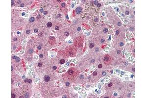 Anti-GSTA1 antibody IHC of human liver. (GSTA1 Antikörper  (AA 1-222))
