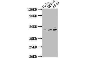 Western Blot Positive WB detected in: Hela whole cell lysate, MCF-7 whole cell lysate, A549 whole cell lysate All lanes: PRKACA antibody at 1:2000 Secondary Goat polyclonal to rabbit IgG at 1/50000 dilution Predicted band size: 41, 40 kDa Observed band size: 41 kDa (PRKACA Antikörper  (Catalytic Subunit alpha))