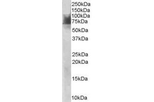 Western Blotting (WB) image for anti-Solute Carrier Family 6 (Neurotransmitter Transporter, serotonin), Member 4 (SLC6A4) (AA 116-126) antibody (ABIN297660) (SLC6A4 Antikörper  (AA 116-126))