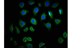 Immunofluorescence staining of A549 cells with ABIN7172278 at 1:166, counter-stained with DAPI. (TLR6 Antikörper  (AA 32-586))