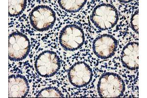 Immunohistochemistry (IHC) image for anti-Adenylate Kinase 3 (AK3) antibody (ABIN1496518) (Adenylate Kinase 3 Antikörper)