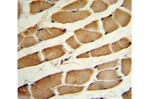 IHC analysis of FFPE human skeletal muscle stained with SMAD4 antibody (SMAD4 Antikörper  (AA 400-428))